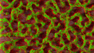Biofilm eines klinischen Isolates