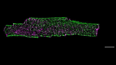 Herzmuskelzelle STED-Mikroskopie