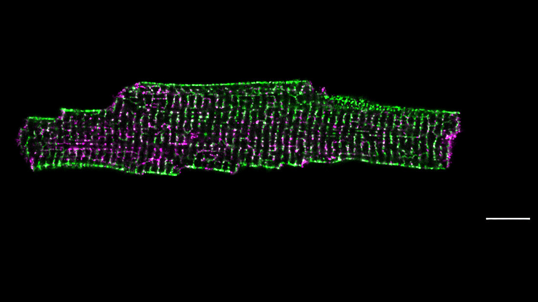 Herzmuskelzelle STED-Mikroskopie