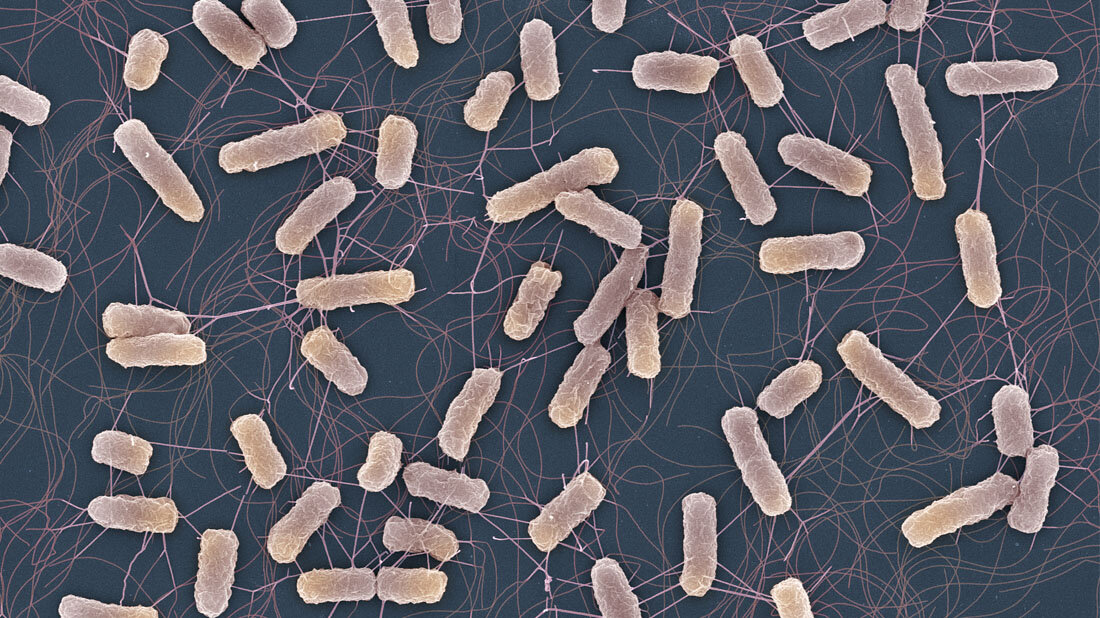 Rasterelektronenmikroskopische Aufnahme von Salmonella-Bakterien