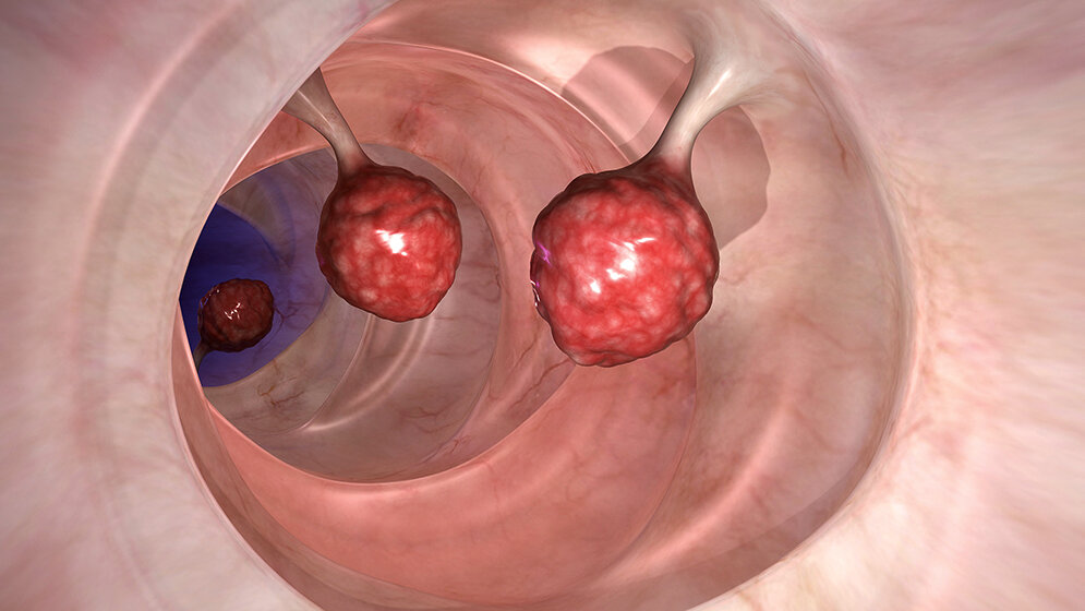 Let’s say it in English Colonoscopy and Enteroscopy