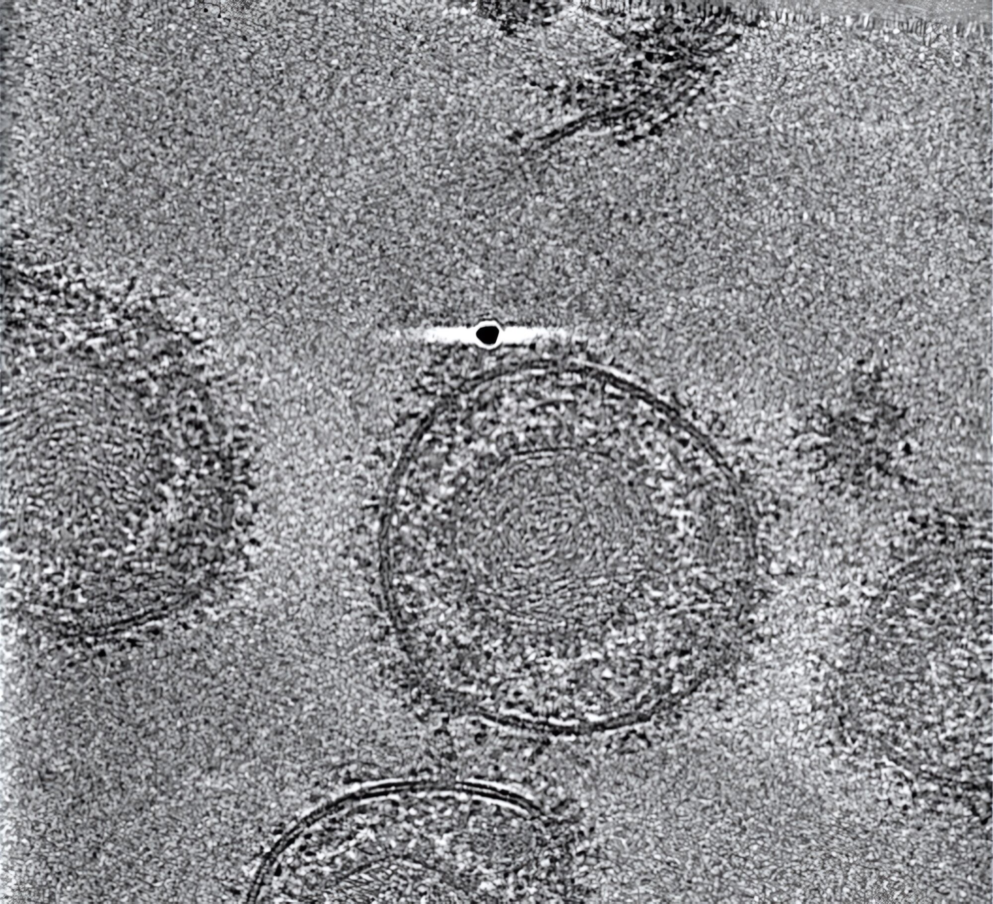 Darstellung von HSV-1-Partikeln mittels Kryo-Elektronen-Tomografie.