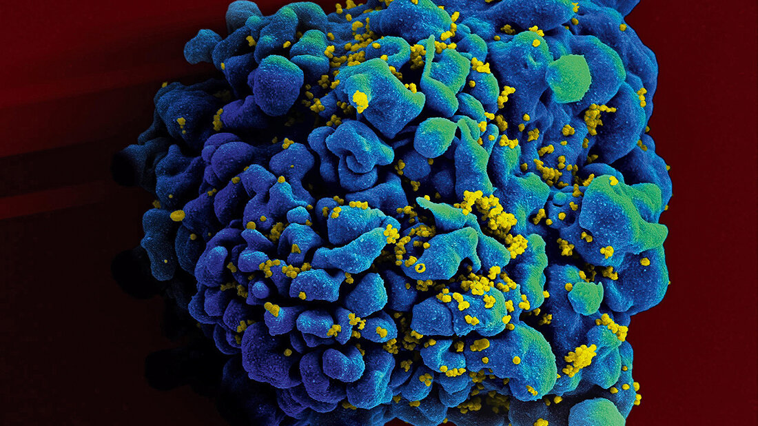 Titelbild zum Fachbeitrag über die akute HIV-Infektion