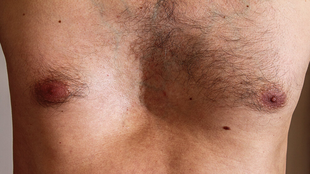 Anomalien und Normvarianten: Skelettale Veränderungen 3.20