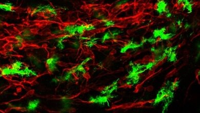 Immunfluoreszenzbild_Gehirn_junger_Maeuse_mit_Cerebraler_Malaria_Universitaetsklinikum_Heidelberg_24052016.jpg Immunfluoreszenzbild vom Gehirn junger Mäuse