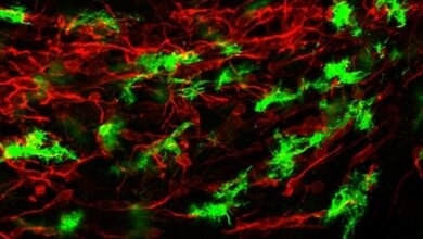 Immunfluoreszenzbild vom Gehirn junger Mäuse 