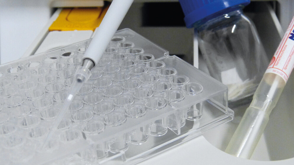 Untersuchung auf Keime in Waschmaschinen 