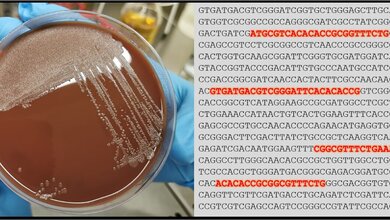 Foto_Haemophilus_Kultur_Ergbutanalyse_FZBtif.jpg Foto_Haemophilus_Kultur_Ergbutanalyse_FZBtif.jpg
