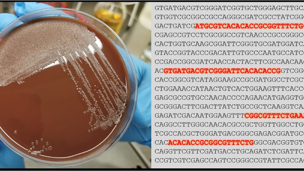 Foto_Haemophilus_Kultur_Ergbutanalyse_FZBtif.jpg