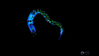 konfokale Mikroskopie von C. elegans nach UV-Bestrahlung