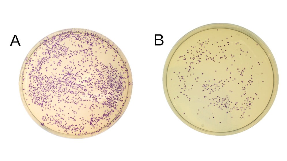 E. Coli-Bakterien, die blaues Protein produzieren