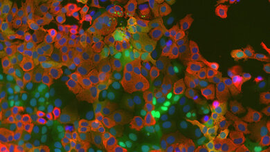 Mikroskopisches Bild mit Zellkernen in blau mit roter Umrandung (Coronavirus) und grünen Punkten (Kinase-Aktivitätsreporter) auf dunkelgrünem Hintergrund