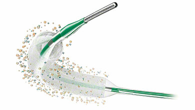 Medikamentenbeschichteter Ballonkatheter