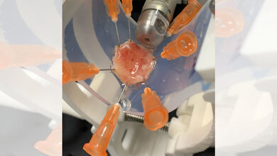 Eine neu entwickelte Endoskopie-Kapsel, die das Gewebe in einem vollständigen 360-Grad-Winkel scannt.