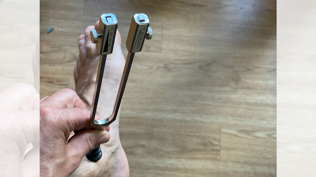 Stimmgabeltest bei Neuropathie