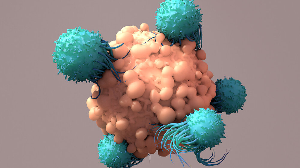 T-Zellen.jpeg T-Zellen bekämpfen Krebs