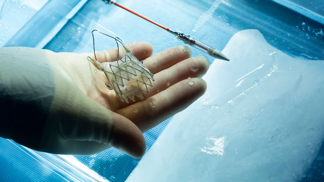 TAVI.jpg Herzersatzklappe