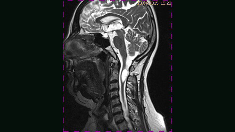 Schnittbilddiagnostik der Wirbelsäule (4.24)
