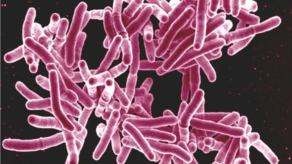 Mycobacterium tuberculosis