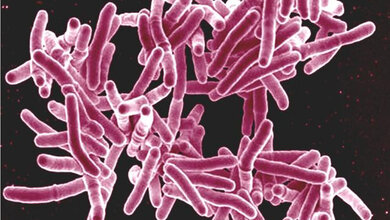 Mycobakterium_tuberculosis_NIAID_CC_BY_2_0.jpg Mycobacterium tuberculosis