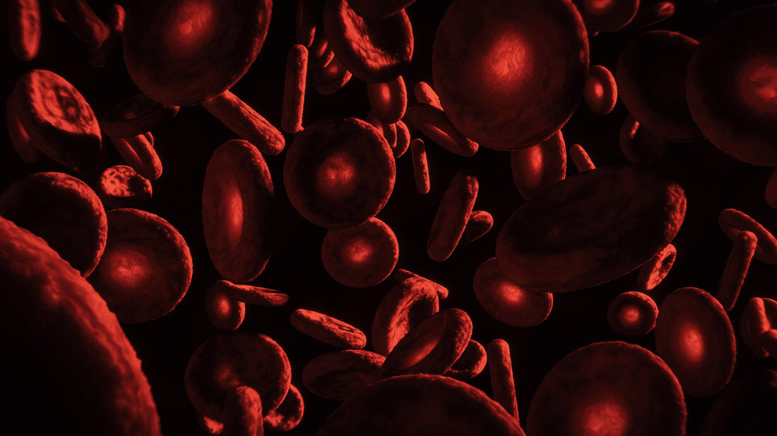 Blut_Adobe.jpg Warum entstehen Antikörper bei Hämophilie A