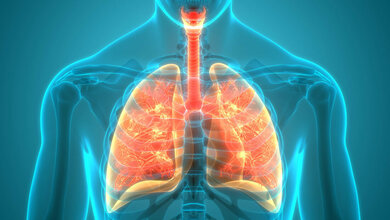 Lunge_CF.jpg Dreifachtherapie bei Mukoviszidose