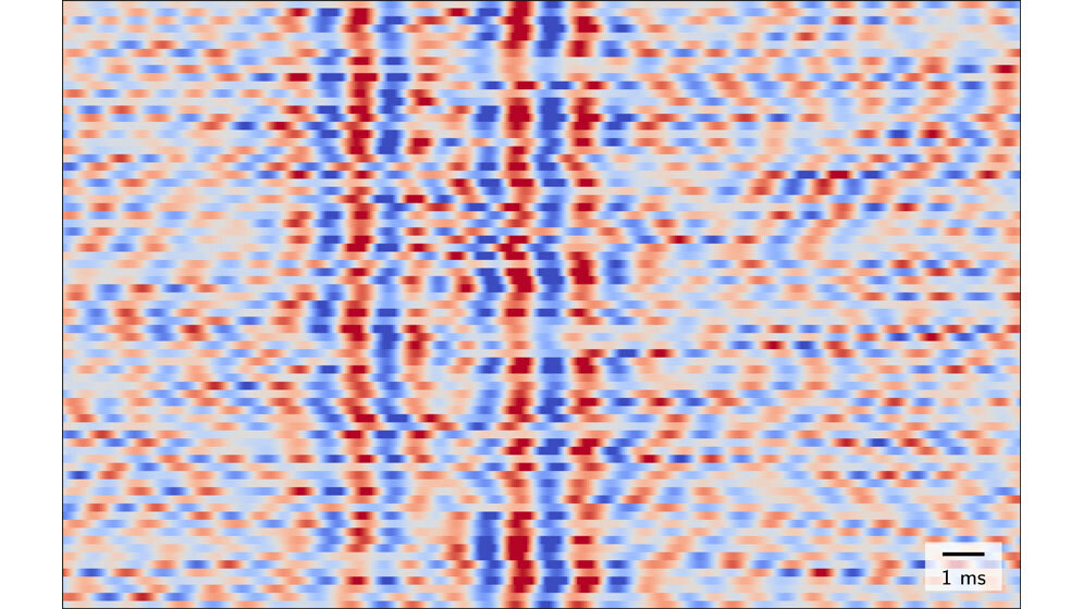 Nichtinvasiv_gemessene_schnelle_Hirnstroeme.jpg Nichtinvasiv gemessene schnelle Hirnströme