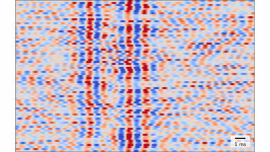 Nichtinvasiv gemessene schnelle Hirnströme 