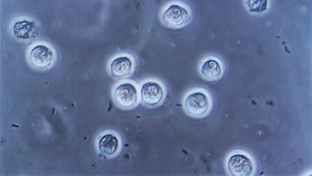 Anzeichen für eine Infektion der Harnwege