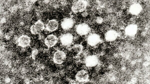 Zytomegalievirus und Parvovirus B19 (2)