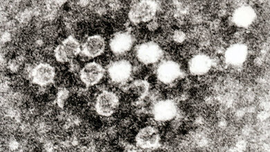 Mikrobiologie Zytomegalievirus und Parvovirus B19 (2)