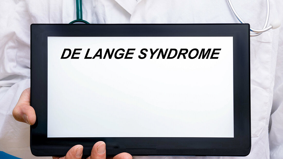 Titelbild zum Fachbeitrag über das Cornelia-de-Lange-Syndrom