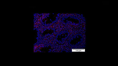 Protein Bcl-3