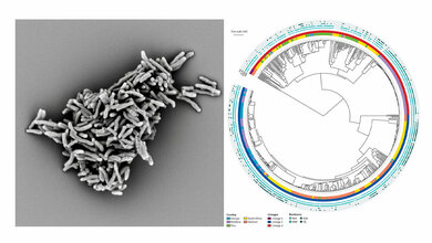 Elektronenmikroskopische Aufnahme von Mycobacterium tuberculosis