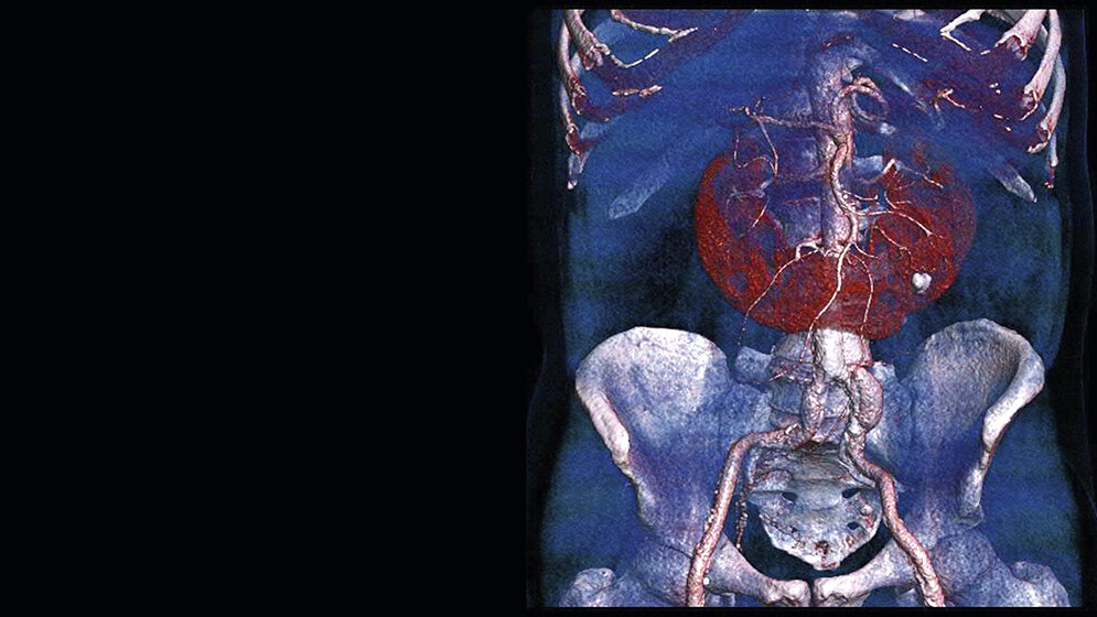 Anomalies and normal variants