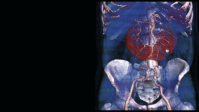 Anomalies and normal variants