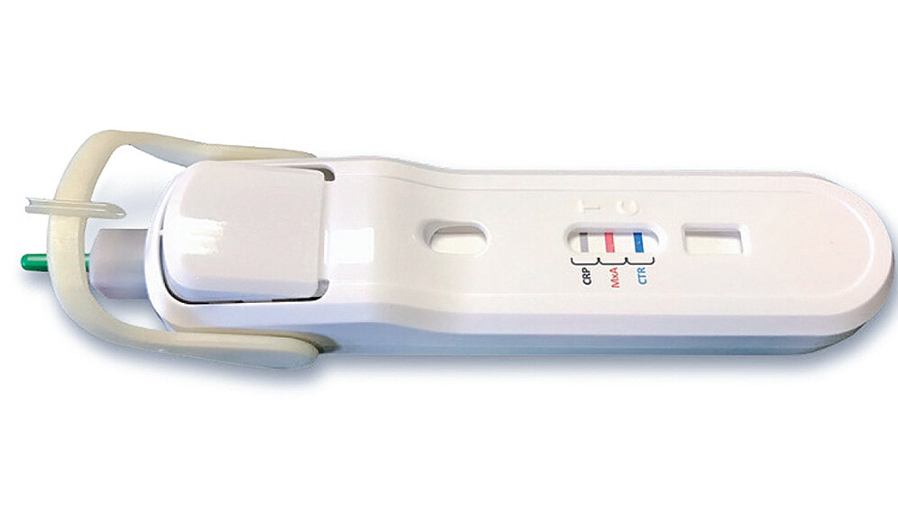 Aus der Industrie Biomarkers Award an FebriDx®