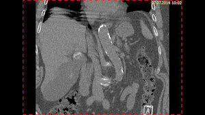 Schnittbilddiagnostik der Wirbelsäule (7.23)