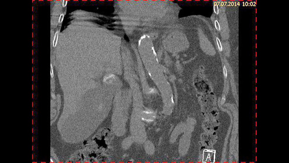 Schnittbilddiagnostik der Wirbelsäule (7.23)