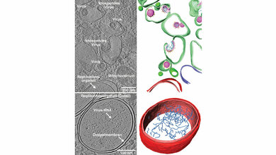 Die_mit_Kryo_Elektronenmikroskopen_entstandenen_Aufnahmen_Uniklinik_HD.jpg Kryo-Elektronenmikroskop