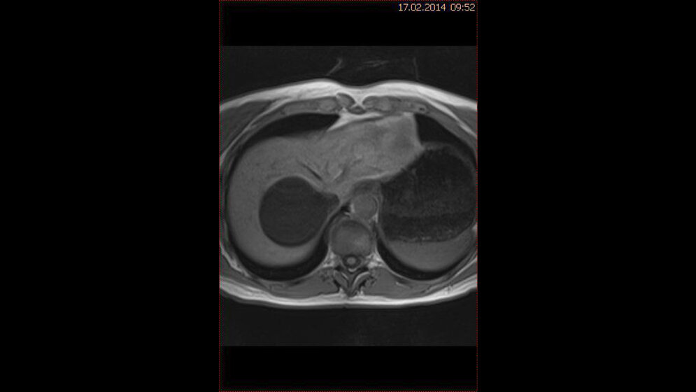 Schnittbilddiagnostik der Wirbelsäule (7.21)