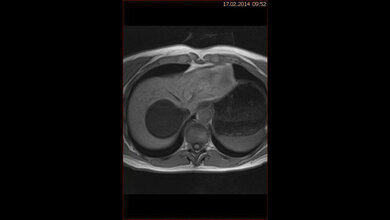 Schnittbilddiagnostik der Wirbelsäule (7.21)