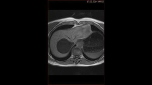Schnittbilddiagnostik der Wirbelsäule (7.21)