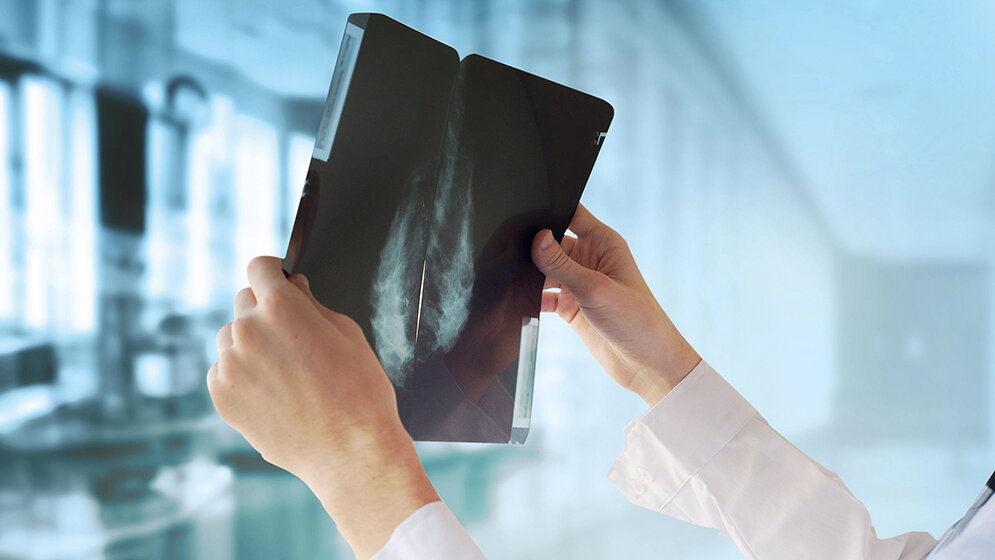 Let’s say it in English X-ray Radiation