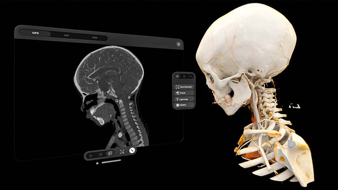 Siemens Healthineers mit neuer App Hologramm des menschlichen Skeletts