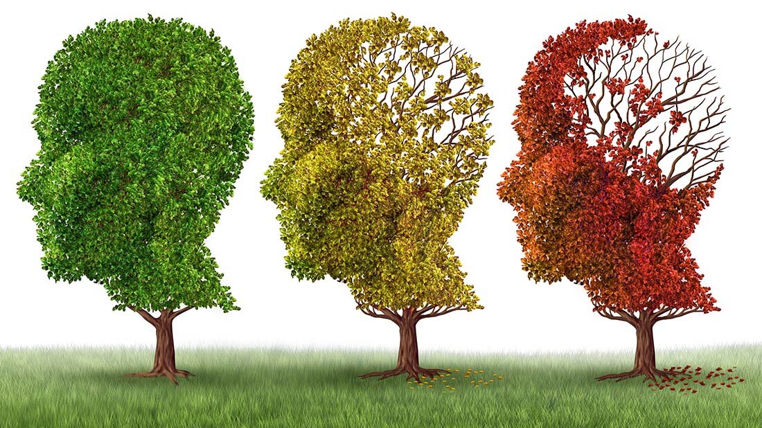 Demenz_online.jpg Kostengünstige Patienten mit vaskulärer Demenz die Hirnfunktion verbessern könnten