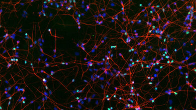 Enzym_Demenz.jpg Mikroskopisches Bild, schwarzer Hintergrund mit roten Verästelungen, an denen zwischendurch blaue und grüne Punkte zu sehen sind.