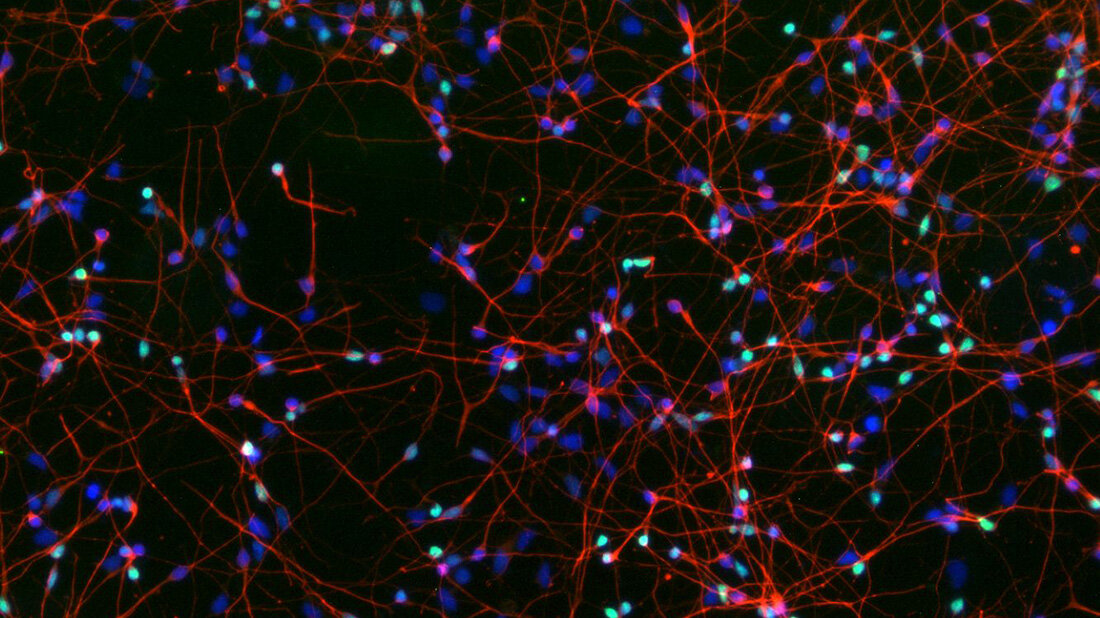 Enzym_Demenz.jpg Mikroskopisches Bild, schwarzer Hintergrund mit roten Verästelungen, an denen zwischendurch blaue und grüne Punkte zu sehen sind.