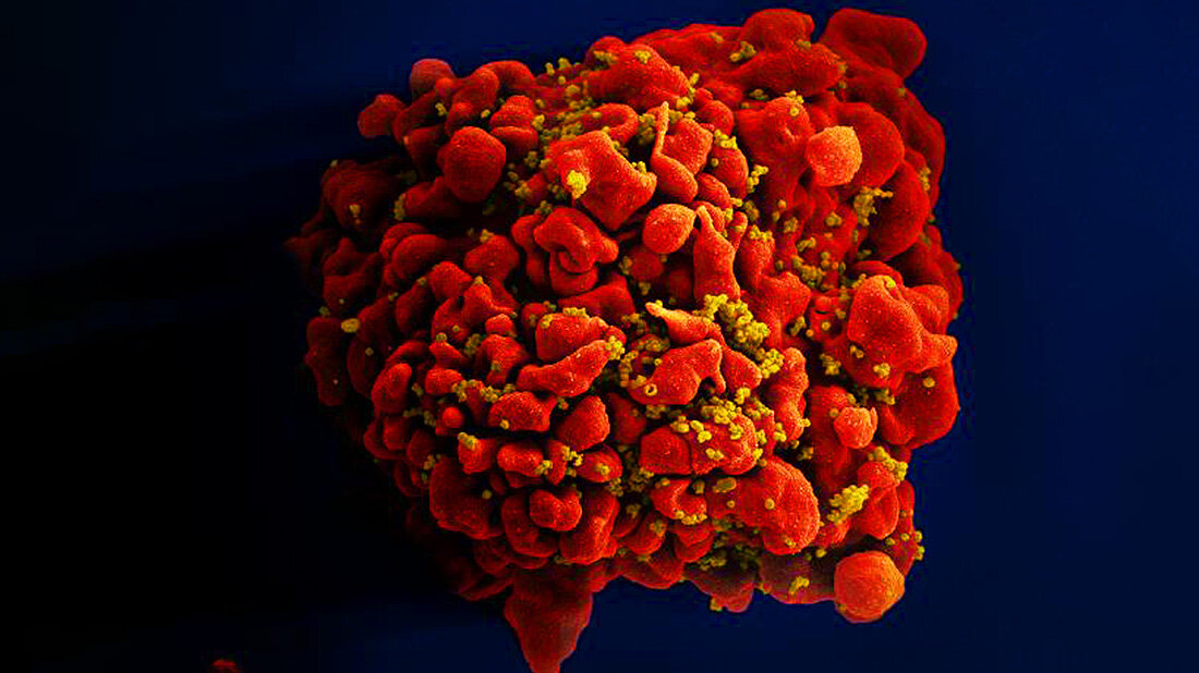 HI-Virus.jpg T-Zelle HI-Virus