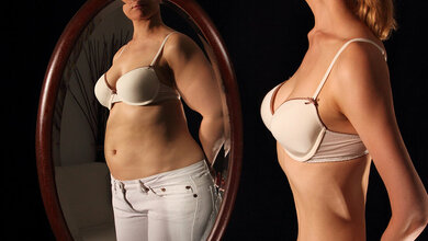 Magersucht: Krankheitsverlauf vorhersagen dank Ki